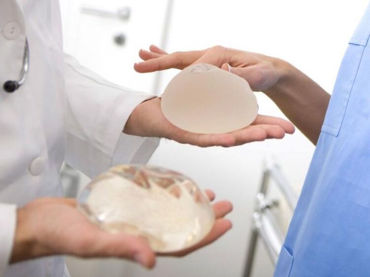 implants