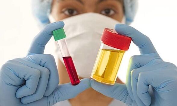 analyses de sang et d'urine avant une chirurgie d'augmentation mammaire