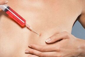 injection mammaire pour augmenter la graisse