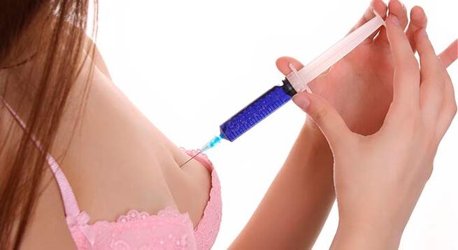 Augmentation mammaire par injections d'acide hyaluronique